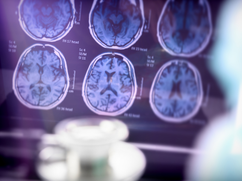 Image of Brain Scans